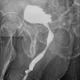 Cystographie