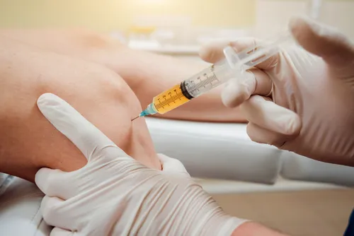 Injection de PRP