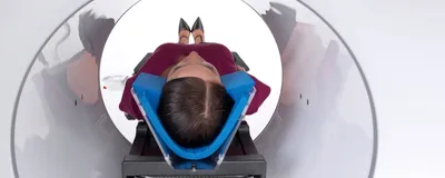 Cone Beam
