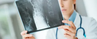 Radiographie